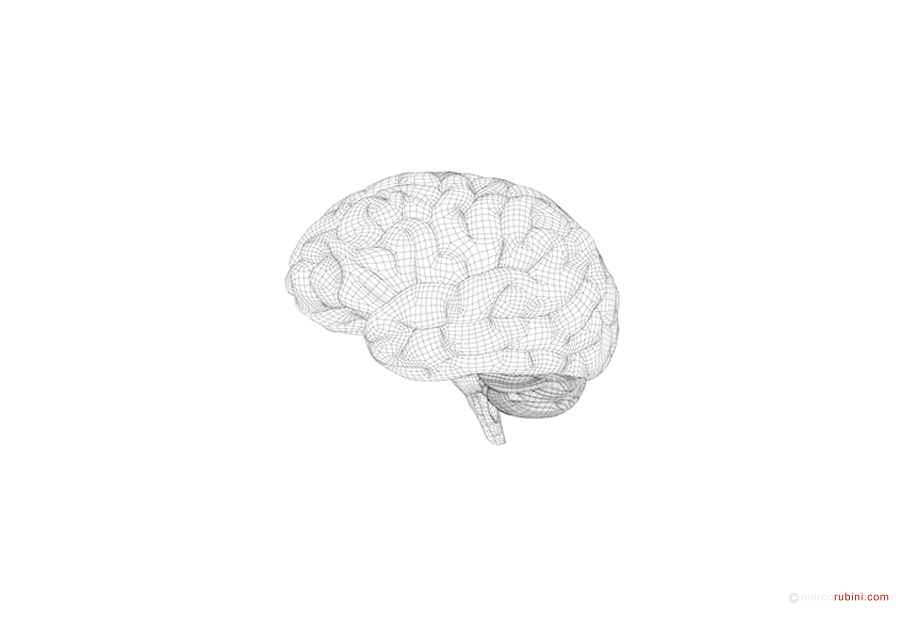 cervello tac risonanza